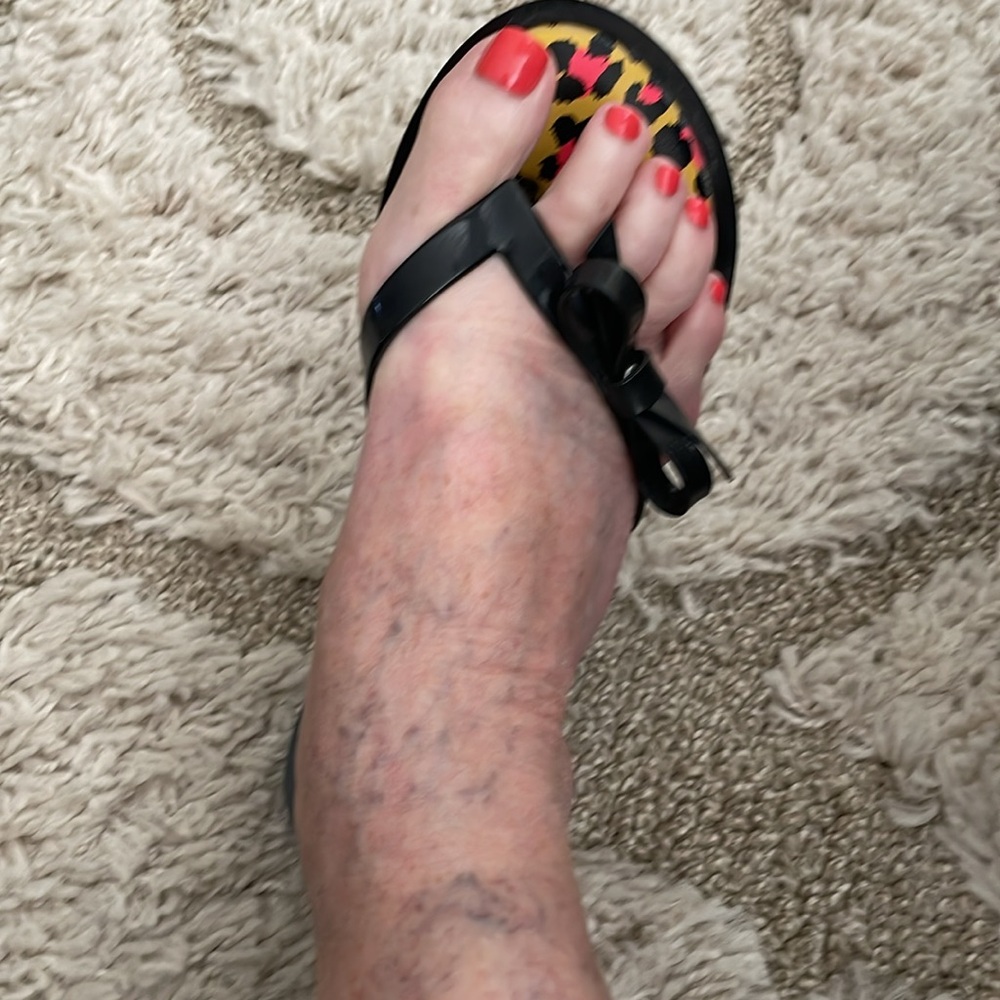 Melissa Flip Flops - Picture 6 of 7
